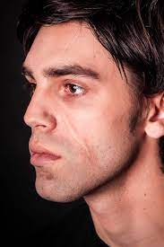 Gummibärchen gehören zu den einfachsten süßigkeiten, die du selbst machen kannst. Narben Einfach Selber Schminken Wir Zeigen Dir Wie Es Geht