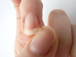 How To Solve Nailbiting Pronails Global