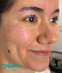 AMORE Clínic (@amore_clinic) • Instagram photos and videos