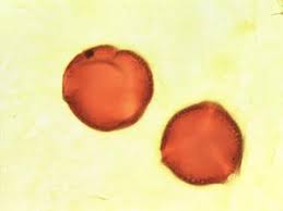 Image result for Pentarhopalopilia umbellulata