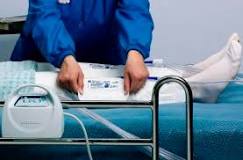 Clinical Tip: How long should mechanical compression devices ...
