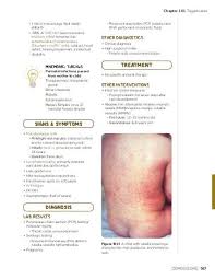 Image result for Rubella