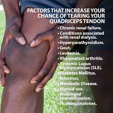 Quadriceps strain is a partial tear of the small fibers of the muscles that make up the quadriceps group. Quadriceps Tendon Tear Florida Orthopaedic Institute