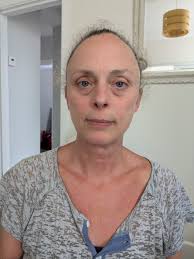 Beautiful before and after love her👏👏👏👏👏❤️❤️❤️❤️