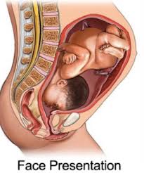 Image result for Face Presentation