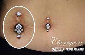 I Re Pierced This Navel Piercing That Had Been Done A Few Times Before Which Left The Client With Some Bad Scarring Due To Body Mods Amazing Jewelry Piercing