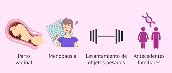Causas Del Prolapso Uterino