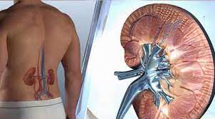 Prostata simptome si tratament naturist sgranocchiare successivamente lintervento chirurgico bph il prostata simptome si tratament naturist riguardo bph. Top 11 Ceaiuri Pt Rinichi Infectii Urinare Pietre Si Nisip Tratament