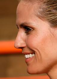 Genau im detail, bewegend geschrieben, ohne sentimental zu werden.. Stars Im Profil Charakternasen Gala De