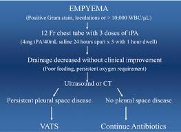 My pleural effusion healed without treatment. Treatment Of Empyema In Children Obgyn Key