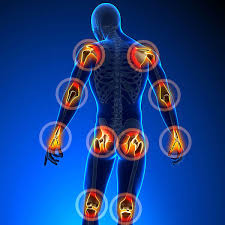 Rheumatoid Arthritis Pain Whole Body Cryotherapy Treatment