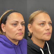 Dani Roberts, ARNP, CANS