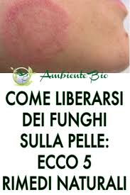 Diagnosi, trattamento e prevenzione i funghi della pelle sono un gruppo di microrganismi in grado di provocare diverse malattie a carico dell'epidermide e del derma, genericamente note come micosi cutanee. Domenico Sagoleo D Sagoleo Profilo Pinterest