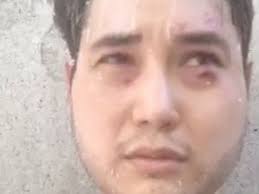 Fundraiser for Andy Ngo by Michelle Malkin : Protect Andy Ngo Fund