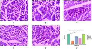 Image result for Lannea edulis