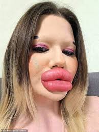 Andrea Ivanova claims, "I have the biggest lips in the world and plan to  make them even larger with more filler," despite fans fearing they might  "burst."