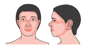 Verdachte huidafwijkingen