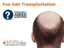 An fue hair transplant can be undergone in either one long session or several smaller sessions. Fue Hair Transplantation Frequently Asked Questions Cyber Hairsure