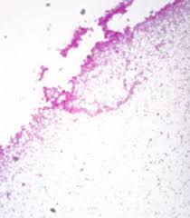 It is a facultative anaerobe, thus capable of using oxygen for aerobic respiration under aerobic conditions, or an alternative terminal electron acceptor for anaerobic respiration under anaerobic conditions. Living Organism Care Guide Rhodospirillum Rubrum Carolina Com