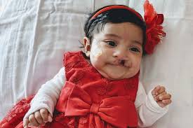 Fundraiser by Lucia Ibarra : Baby Genesis Ibarra Cleft Lip Surgery
