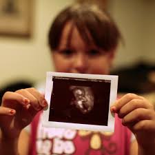 Study: Fetuses Prefer Face-Like Images Even in the Womb