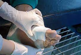 5 days cephalosporin is as effective as 10 days penicillin. Gangrene Infection Causes Symptoms Treatment Wet Vs Dry