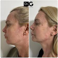 Claroo, lo que el paciente pida 🤐