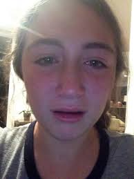 Neck cracking (@Kierons10848789)