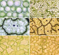 Plants possess a skin called the epidermis. Light Microscopic Photomicrographs Of Spinacia Oleracea Leaf Fresh Download Scientific Diagram