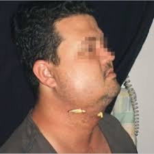 Rafael SANTIAGO DE ALMEIDA