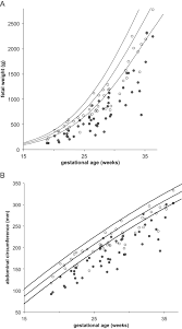 Fetal Growth According To Different Reference Ranges In Twin