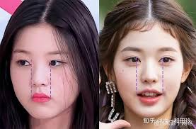 为什么我整了牙，笑起来还是不好看- 知乎