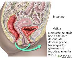 Spanish Hie Multimedia Infeccion Urinaria En Adultos