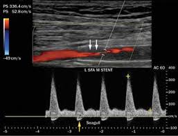Pin On Vascular Technology