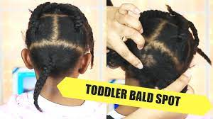 Braided Hairstyles To Cover Bald Spots Easy Braid Haristyles