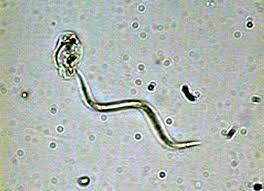 Image result for Raphidiocystis