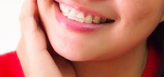If you need a bottom teeth retainer as well as one for your top teeth, this could mean up to £800 in total. Should I Get Permanent Or Removable Retainers Bayside Dental Orthodontics