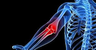 Dizde Belde Ve Boyunda Kireclenme Neden Olur Belirtileri Nelerdir Saglik Haberleri