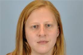 Rhinoplasty Before and After Photos by Paul Vanek, MD, FACS; Concord, OH