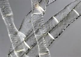 Check spelling or type a new query. Spirogyra Filamentous Algae Olympus Ls