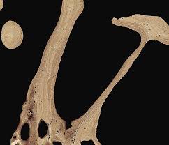 Compact bone, spongy bone, and bone marrow. Bone Cross Section Photograph By Science Photo Library
