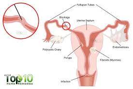 Get pregnant faster through accurate and personalized mira fertility system. Self Care Tips For Blocked Fallopian Tubes Emedihealth Fallopian Tubes Blocked Fallopian Tubes Fallopian Tube Blockage