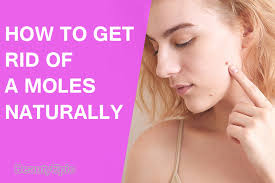 And does anyone know a place in boston that would do it? How To Get Rid Of Moles Naturally