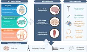 Expert eye care · use your fsa/hsa · top brand names Rupture Reconstruction And Rehabilitation A Multi Disciplinary Review Of Mechanisms For Central Nervous System Adaptations Following Anterior Cruciate Ligament Injury The Knee