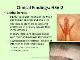 Herpes simplex virus, more commonly known as herpes affects 1 in 6 people. Herpes Virus
