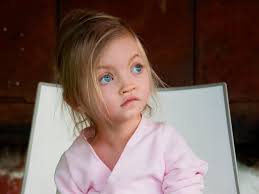 Wolf Hirschhorn Syndrome Symptoms And Diagnosis