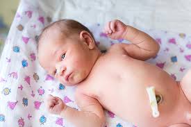 The umbilical cord stump usually falls off in. 6 Tips To Take Care Of Your Baby S Umbilical Cord