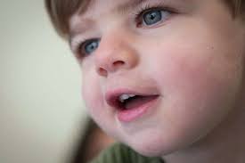 After brain injury at day care, Walker Hicks continues recovery