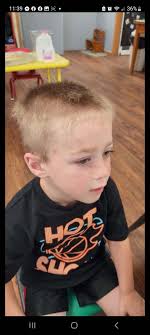 School-aged children with Alpha Gal allergy experiences needed