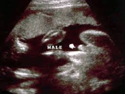 Pin On All Things Pregnancy